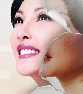 祛斑護膚的好方法-菲菲美人館