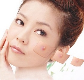 火鍋一族 五步擺脫冬季痘痘肌-菲菲美人館