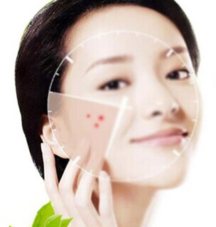 祛痘不留痕小竅門-菲菲美人館