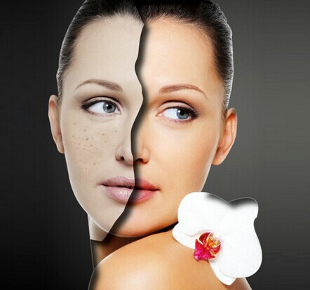 祛斑大法 內外兼修雙效管理-菲菲美人館