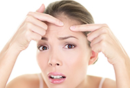 想要祛痘 你知道這些痘痘屬性嗎?-菲菲美人館