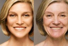 4個美白去皺紋的方法-菲菲美人館