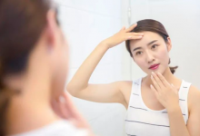 祛痘印的小竅門 祛痘不留“印“象-菲菲美人館