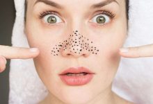 鼻子黑頭怎么去除-菲菲美人館