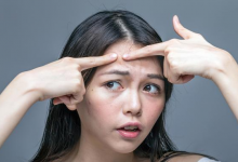 額頭祛痘的小竅門-菲菲美人館