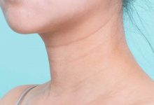 頸紋是怎么形成的 如何消除頸紋保養你的頸部皮膚-菲菲美人館