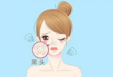 傳授你去黑頭的護膚三步驟-菲菲美人館