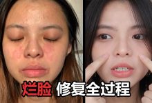 修復皮膚的方法有哪些 如何修復皮膚效果好-菲菲美人館